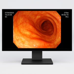 Endoscopy imaging displayed on an OLED medical display panel showing high contrast and color accuracy
